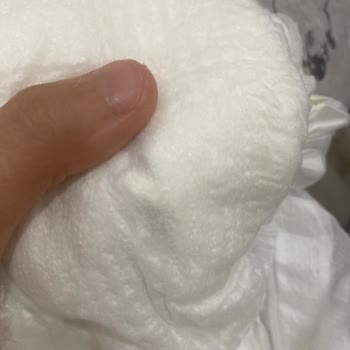 Bebek Bezi Ürün Güvenliği Hakkında Şikayet