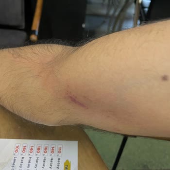 Turkcell Bayisinde Çalışan Tarafından Fiziksel Şiddete Uğradım, Güvenliğim Tehlikeye Girdi