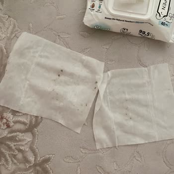 Aldığım Islak Mendillerde Küf Çıktı, Mağduriyet Yaşıyorum