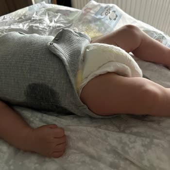 Prima Bebek Bezlerinde Sürekli Sızdırma Sorunu