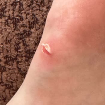 Mango'dan Aldığım Terlik Ayaklarımı Yaraladı