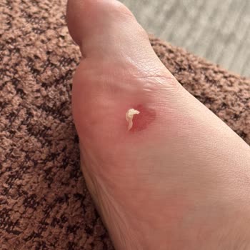 Mango'dan Aldığım Terlik Ayaklarımı Yaraladı