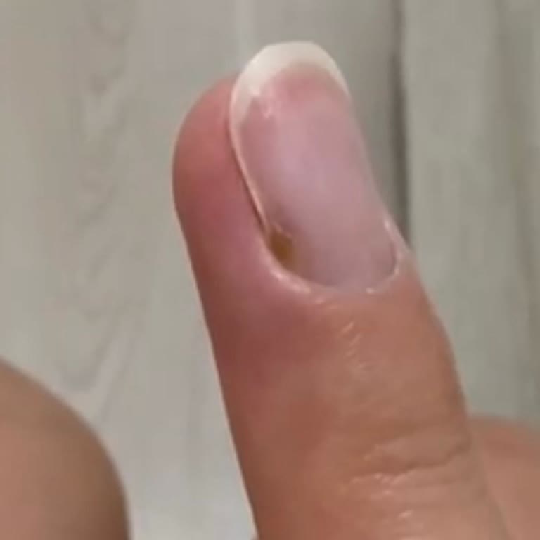 Gizem Macit Beauty Hijyen Eksikliği Ve Sağlıksız Uygulamalar Mağduriyet Yarattı