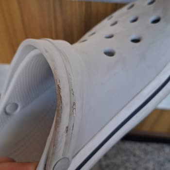 Bir Haftada Yıpranan Crocs Terlik Ve Kullanıcı Hatası Mağduriyeti