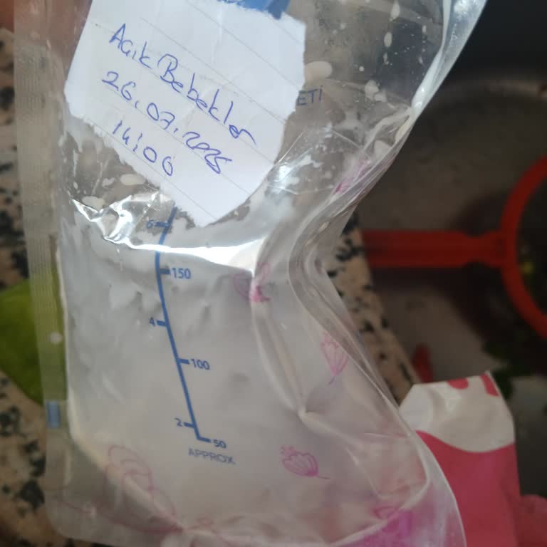 Wee Baby Süt Saklama Poşetleri Delik Çıktı Anne Sütüm Ziyan Oldu