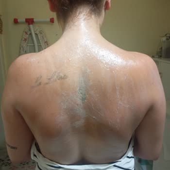 Eda Taşpınar Yaktı ve Güneş Lekesi Yaptı