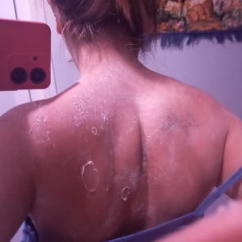 Eda Taşpınar Yaktı ve Güneş Lekesi Yaptı