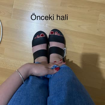 Yüksek Fiyatlı Skechers Sandaletin 2 Kullanımda Deforme Olması Ve Boyner'in İade Reddi