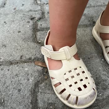 Aldığım Ayakkabının Önü Hemen Boya Verdi, Çözüm Gecikiyor