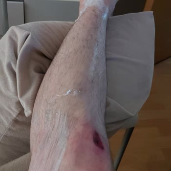 Mondial Motorumun ABS Arızası Ve Yetersiz Servis İlgisi Mağduriyet Yaşatıyor