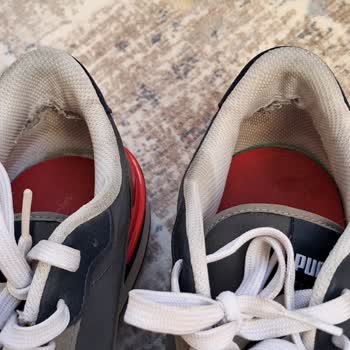 Kısa Sürede Deforme Olan Ayakkabıya Red Cevabı Ve Hayal Kırıklığı