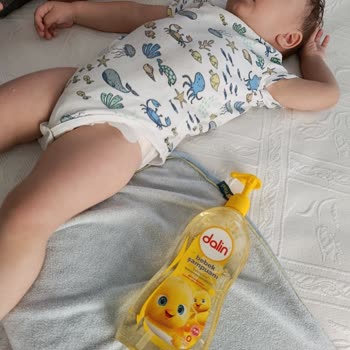 Dalin Şampuan Sonrası Bebeğimde Ciddi Alerjik Reaksiyon Yaşadık