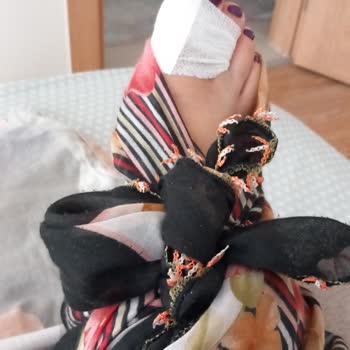 Hayal Kırıklığıyla Başlayan Tatil Ve Yaşanan Talihsiz Kaza