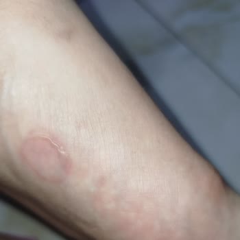 FLO'dan Aldığım Polaris Terlik Ayağımı Yaraladı, İade Talep Ediyorum