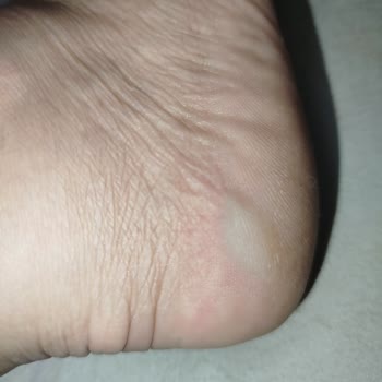 FLO'dan Aldığım Polaris Terlik Ayağımı Yaraladı, İade Talep Ediyorum