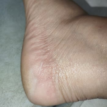 FLO'dan Aldığım Polaris Terlik Ayağımı Yaraladı, İade Talep Ediyorum