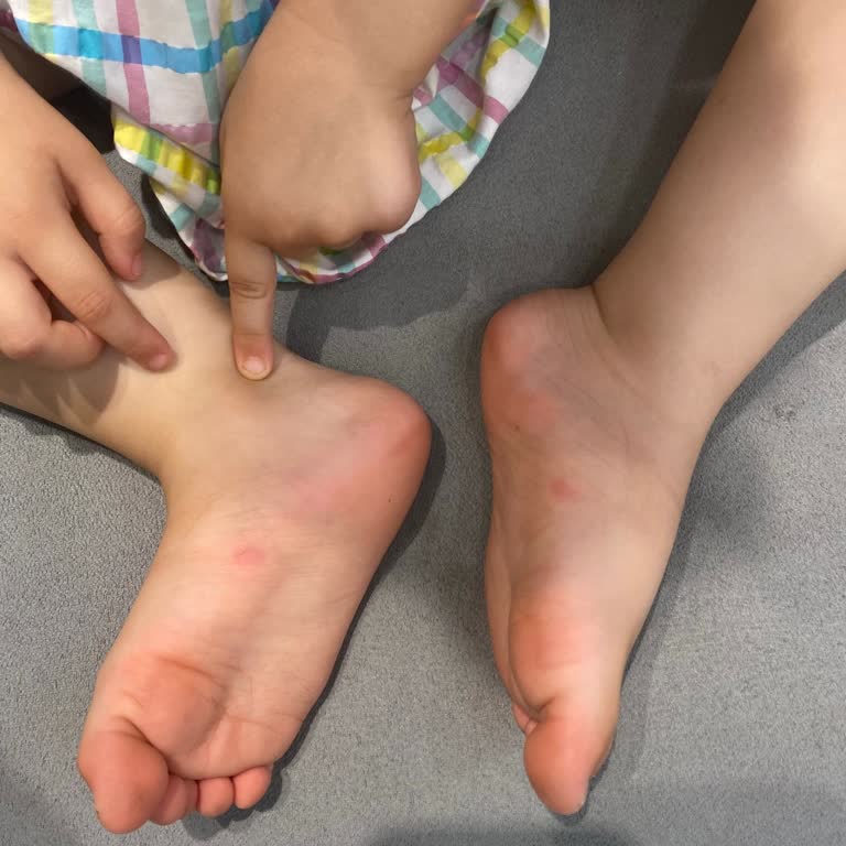 Çocuğumun Ayağında Yaraya Sebep Olan Ayakkabı İçin Çözüm Bulunmadı