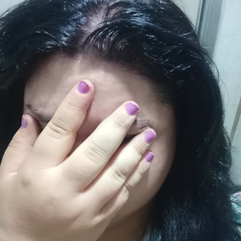 Şok Marketler Saç Boyası Kullanımı Sonrası Saçlarımda Yanma Ve Renk Sorunu Yaşadım