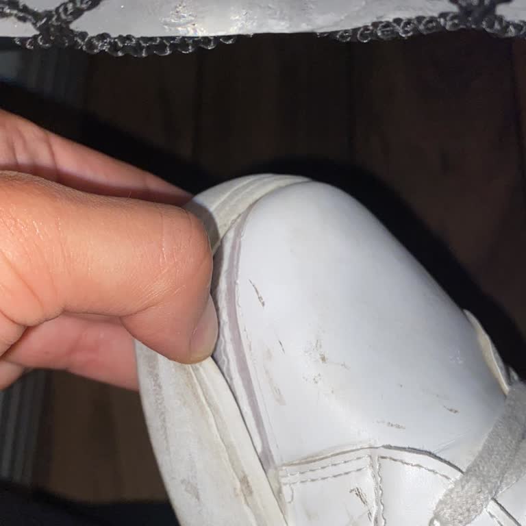 Aldığım Ayakkabı Kısa Sürede Deforme Oldu, İade Kabul Edilmiyor