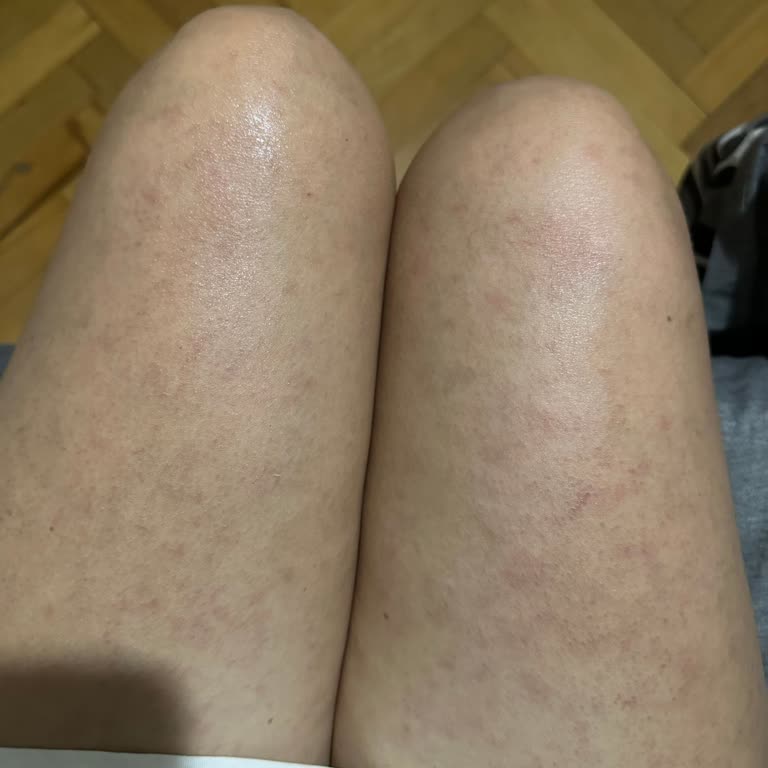 Özel Novapol Poliklinik Aldığım Seansların Tamamını Kullandırmadı