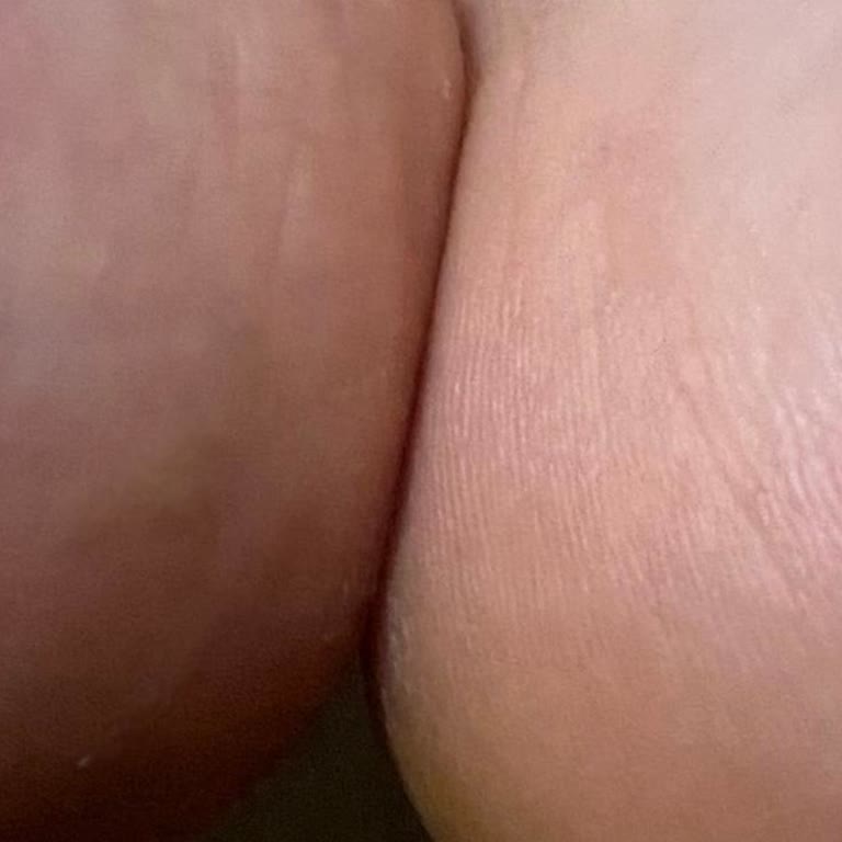 FLO'dan Alınan Puma Ayakkabının Ayağımı Yaralaması Ve Yetersiz Müşteri Desteği