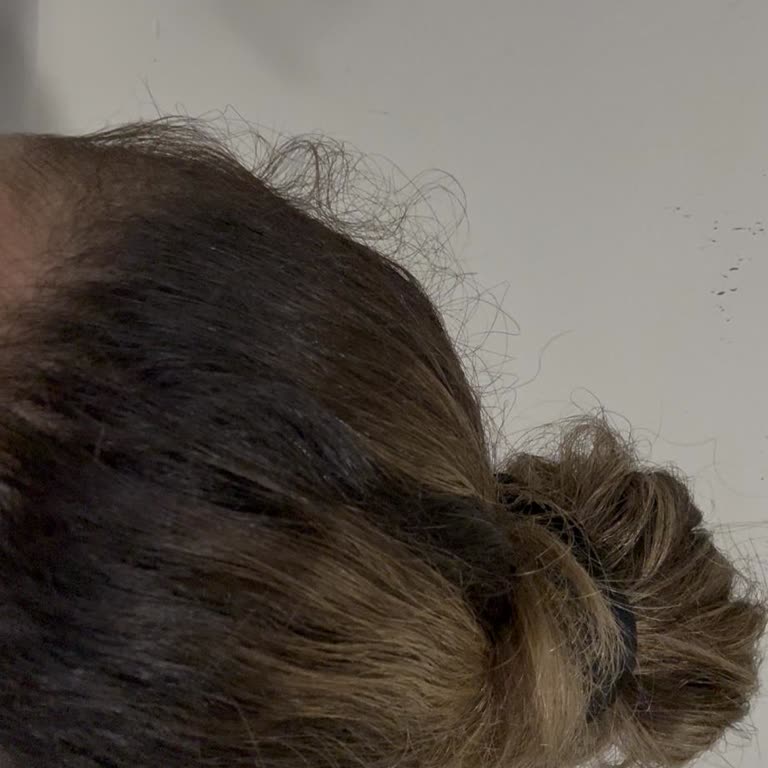 Saç Boyası Sonrası Kötü Sonuç Ve İlgisiz Yaklaşım