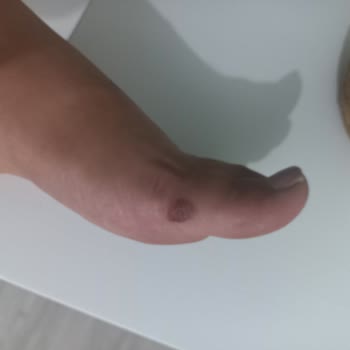 Kısa Sürede Ayakları Yaralayan Ayakkabıya Çözüm Bulunmuyor