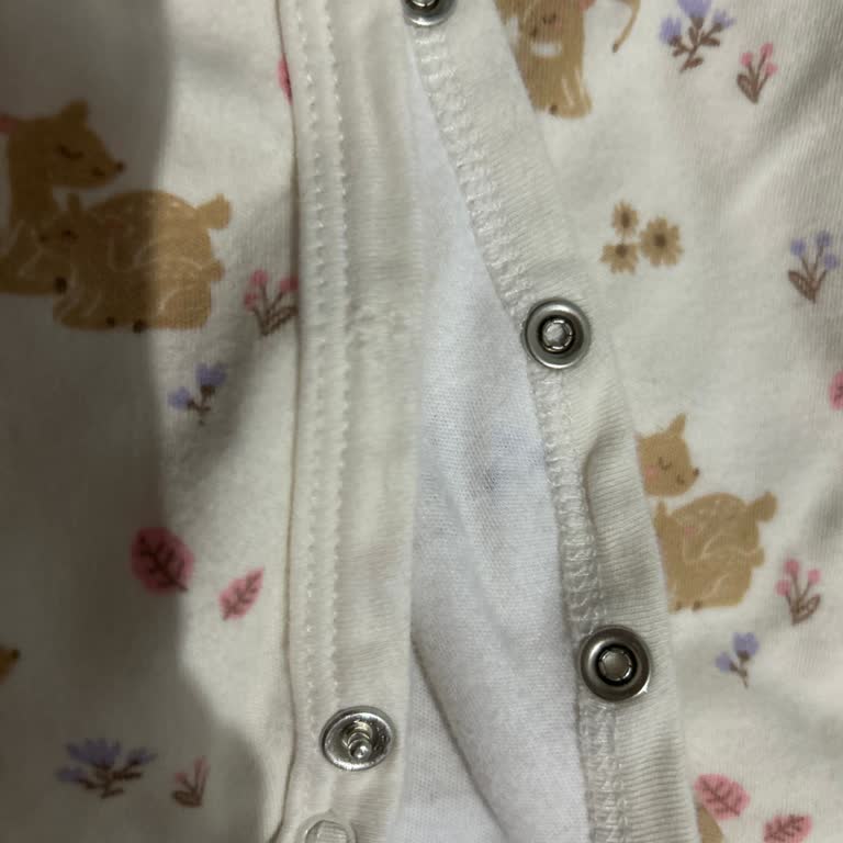 Bebek Tulumunda Kopan Çıtçıt Sağlık Riski Oluşturuyor!