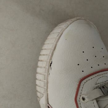 Updigo 1 Ayda Çatlayan Ayakkabıya Çözüm Sunulmadı, Garanti Süreci İşletilmiyor