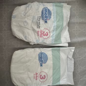 Aldığım Molfix Bebek Bezinde Baskı Ve Özellik Eksikliği, Geri Dönüş Sağlanmadı