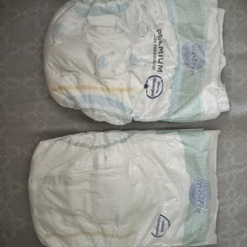 Aldığım Molfix Bebek Bezinde Baskı Ve Özellik Eksikliği, Geri Dönüş Sağlanmadı