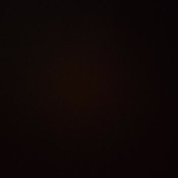 Eksik Gönderilen Ürün İçin İade Ve Para İadesi Sorunu