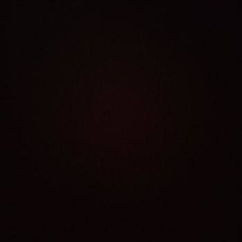 Eksik Gönderilen Ürün İçin İade Ve Para İadesi Sorunu