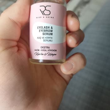 Gözlerimde Yoğun Yanma Hissi Yaşadım