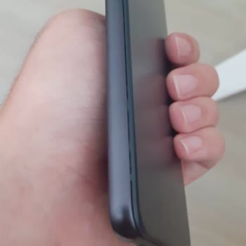 Servis Sonrası Eksik Onarım Ve Mağduriyet