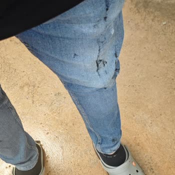 Oto Yıkamada Yağ Bulaştı Kıyafetim Ve Arabam Kirlendi Çözüm Sunulmadı