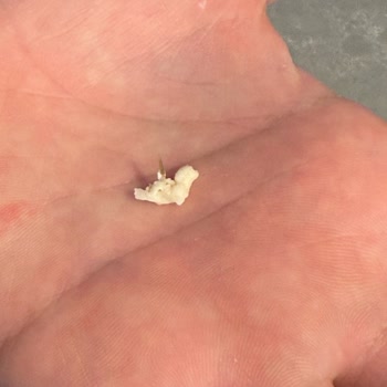 Milföy Hamurunda Böcek Bacağına Benzeyen Yabancı Parça Şoku!