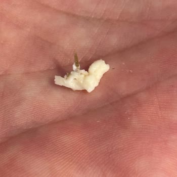 Milföy Hamurunda Böcek Bacağına Benzeyen Yabancı Parça Şoku!