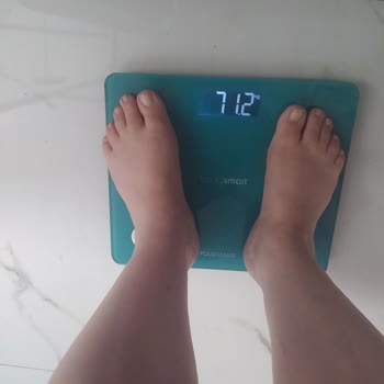 Polosmart Baskül Sürekli Hatalı Sonuç Veriyor, Mağdurum!