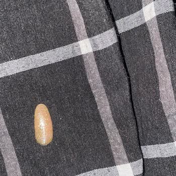 Hatalı Protez Tırnak İşlemi Sonrası İlgisiz Ve Saygısız Müşteri Yaklaşımı