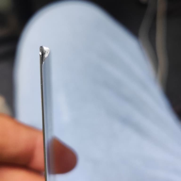 Papara Full Metal Kartta Kalite Sorunu ve Çözüm Eksikliği