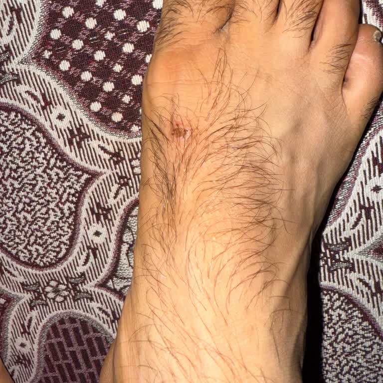 Ayakkabı Yaraladı Değişim Ve İnceleme Süreçleri Mağdur Etti