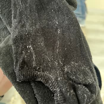 Hamilelikte Çamaşır Makinesi Mağduriyeti Ve Değişim Talebine Ret