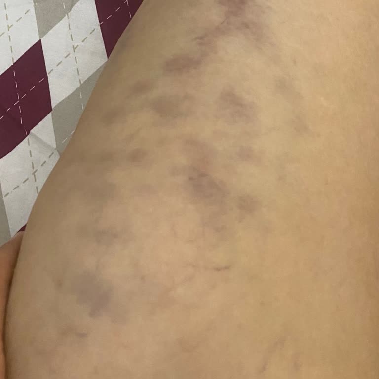 Gratis Beşiktaş Şubesinde Yetersiz Hizmet Ve İlgisiz Çalışanlar Nedeniyle Mağduriyet