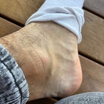 Acil Serviste İlgisizlik Ve Yetersiz Müdahale Sonucu Mağduriyet