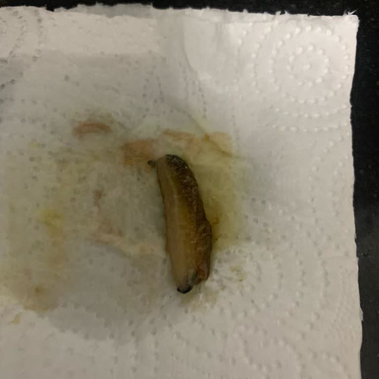 Çocuğumun Takviyesinden Çıkan Canlıyla Şok Oldum