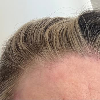 İlgisiz Ve Deneyimsiz Çalışan Nedeniyle Saçım Mahvoldu