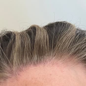 İlgisiz Ve Deneyimsiz Çalışan Nedeniyle Saçım Mahvoldu