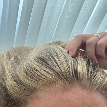 İlgisiz Ve Deneyimsiz Çalışan Nedeniyle Saçım Mahvoldu