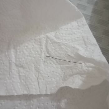 Hacı Bekir Künç Gaziantepli Pastada Yabancı Maddeyle Karşılaştım, Sağlığım Tehlikeye Girdi